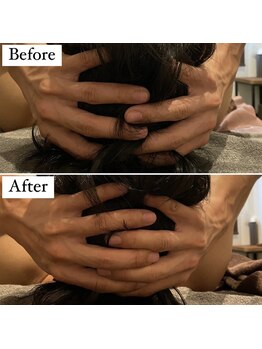 東京デトックス/高濃度炭酸ドライヘッドスパ