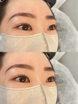 アイビューティートロント(i beauty Toronto)/ハリウッドブロウリフト◎まつげ