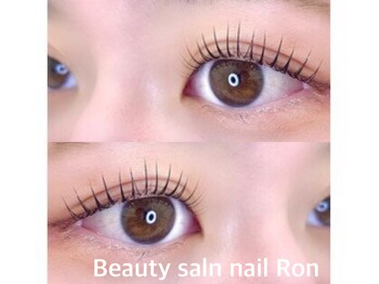 ビューティーサロン ネイル ロン(Beauty Salon nail Ron)の写真