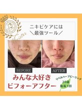 ルキア(LUKIA)/消えないあとが出る前にやっとこ