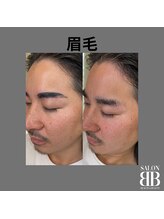 ビービー(BB)/眉毛