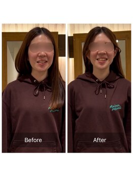 エスボディジャパン(S-BODY JAPAN)/顔の歪み・むくみ改善例