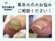 巻き爪補正店 横浜駅前店の写真/足のお悩みを豊富な経験と技術で改善いたします◎プライべ―ト空間でコンプレックスも相談しやすい♪