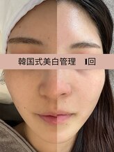 ビューティーセイバー 馬車道(BEAUTY SAVIOR) 美白管理 が得意