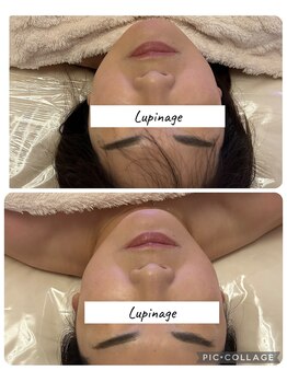 ルピナージュ(Lupinage)/【肌質改善】‐小顔ヘッドスパ‐