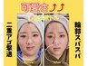 【最新韓国脂肪分解★】速攻小顔レモンボトル3CC　20分¥8000