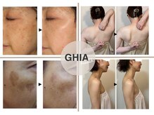 ギア ヘルス(GHIA health)の雰囲気(ヘッドスパ付♪毛穴/シミ/しわ改善FACIAL◎モニター募集中!!)
