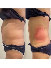 ルミナス/冷却直後のリアルな様子！