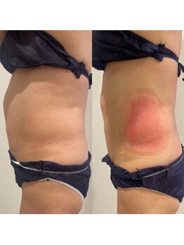 ルミナス/冷却直後のリアルな様子！