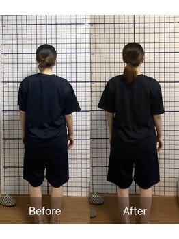 幸鍼灸整体院 武庫之荘院/整体・トレーニング・姿勢変化16