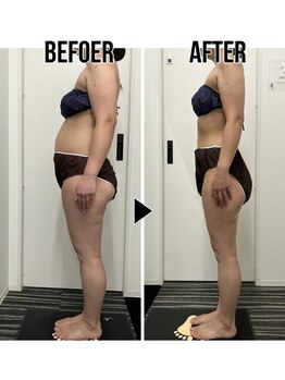 テラピ 藤江店/1か月半で本気痩せ結果出し◎