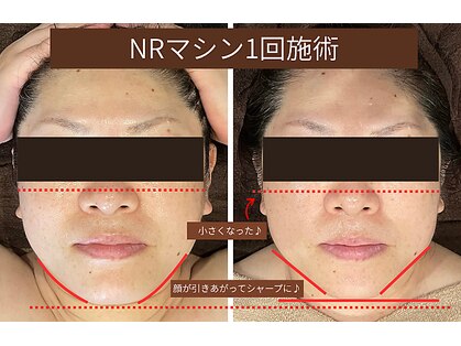 ここはなの写真