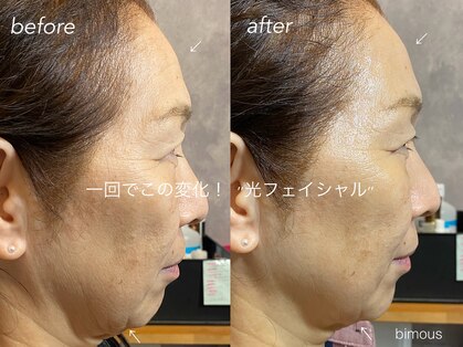 ビモアス(bimous)の写真