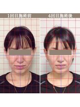シェア 人形町店(Chare)/【小顔・骨盤矯正・О脚・整体】