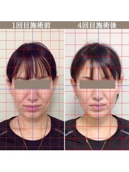 シェア 人形町店(Chare)/【小顔・骨盤矯正・О脚・整体】