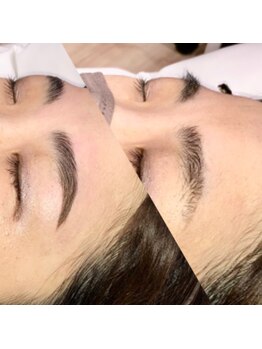 ヴィプラス(Vi+)/