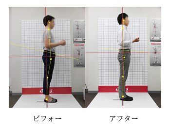 ほねつぎ 平成けやき通り鍼灸接骨院/骨盤矯正ビフォーアフター4