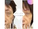 ラ ボーテ(La Beaute)の写真