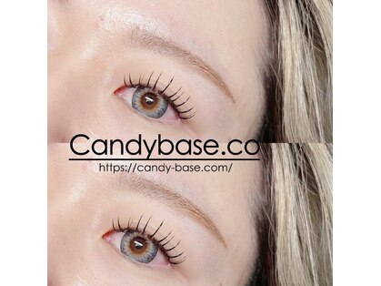 キャンディベース ノースアップ(Candybase North up)の写真