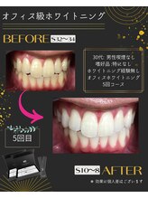 ホワイトニングプラス(Whitening+)/美容で満足しきれなかった方