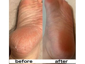 ラフルール(LA FLEUR)/よもぎ蒸し