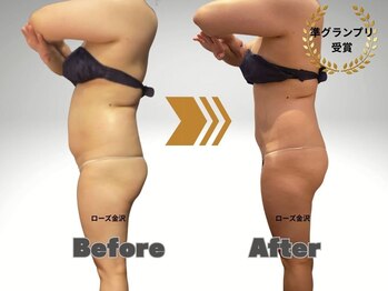 メディカルエステサロン ローズ 金沢本店(ROSE)/【ボディ部門】準グランプリ