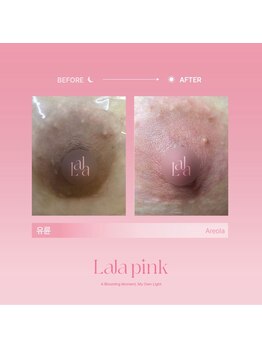 カルム(Calme)/Lalapink