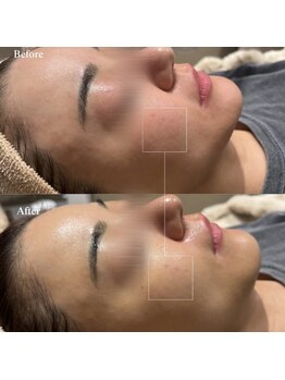 韓美(KANBI)/韓国肌管理Before After