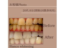 ブランコ 東大宮駅前店(Blanco)の雰囲気（早く白くしたい/違和感のない仕上がりにしたい等オーダーOK!）