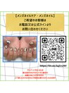 メンズネイルは要問い合わせです