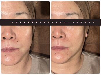 ドアディ(Doordie)/看護師ハイサーマ