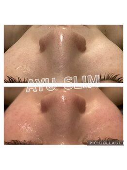 アユスリム(AYU SLIM)/毛穴ケアをしたい