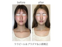 ビジュー(bijoux)の雰囲気（小顔と美肌が一度で「圧倒的なツヤ」と見違える小顔を手に入れて）