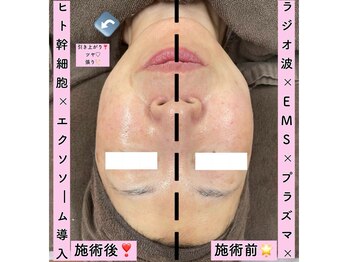 エスポワール(Espoir)