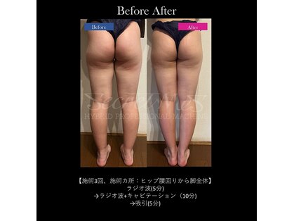 ナルシストサロンの写真
