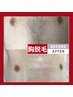 【長期間効果持続】メンズ全身脱毛★都度払いモニター¥49,000→¥19,500
