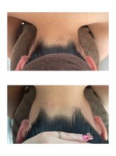 ミース 北九州店/うなじ◇ビフォーアフター