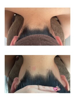 ミース 北九州店/うなじ◇ビフォーアフター