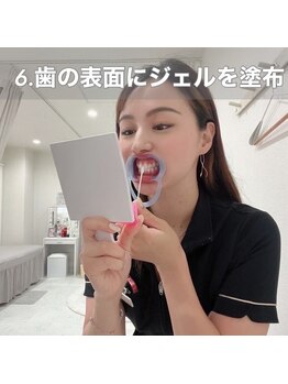 ホワイトニングショップ 西尾店/6、歯の表面にジェルを塗布