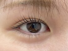 グラルト(GLALT)/