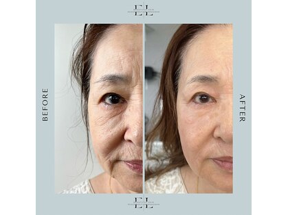 レミュ(Les mieux)の写真