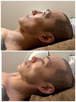 吉川美南ライフ整骨院/40代男性