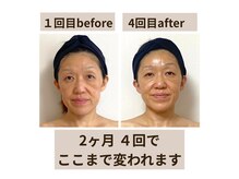 ビィミング(beaming)の雰囲気（身体から整えてキュッと引き締まった小顔に）