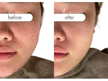 リスタ(RSTA)の写真