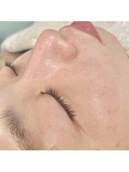 ルミエール(Lumiere)/アクアシュアH2水素フェイシャル