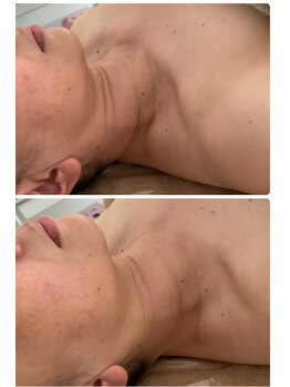 パーム(Palm)/若々しい首元に