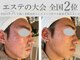 ひかり素肌の写真