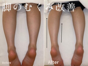 グレース 吉祥寺(grace)/スッキリ脚元へ♪