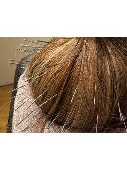 スゴ腕の施術者がいるサロン