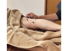狭山池尻みやび鍼灸マッサージ院/冷え対策には台座灸◎